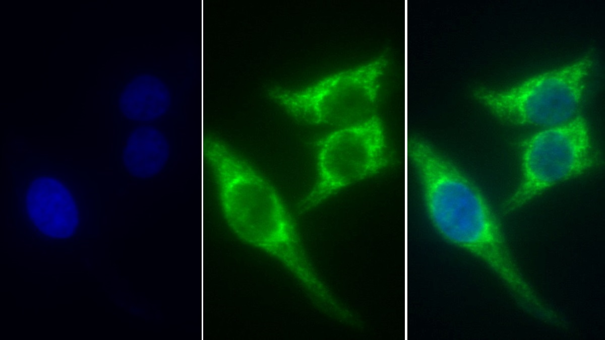 Monoclonal Antibody to Succinate Dehydrogenase Complex Subunit A (SDHA)