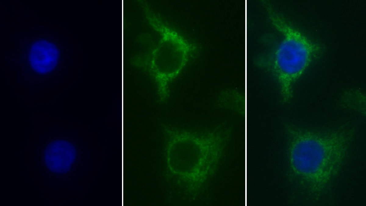 Monoclonal Antibody to Succinate Dehydrogenase Complex Subunit A (SDHA)