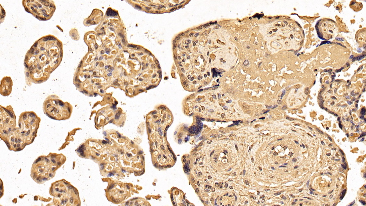 Monoclonal Antibody to Tyrosine 3/Tryptophan 5 Monooxygenase Activation Protein Zeta (YWHAz)