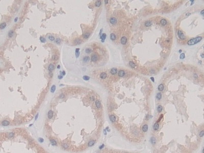 Monoclonal Antibody to Transmembrane Protein 27 (TMEM27)