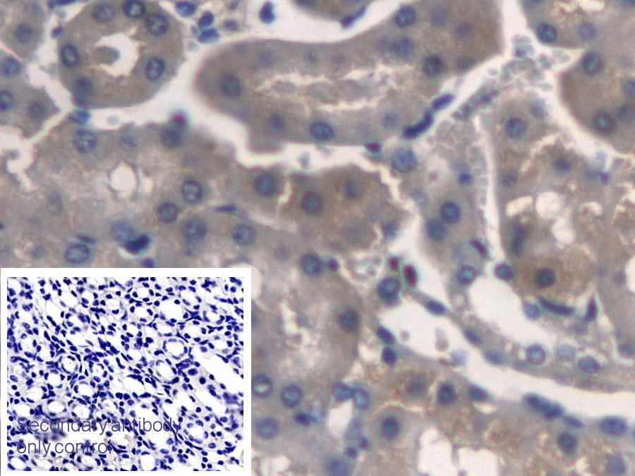 Monoclonal Antibody to Transmembrane Protein 27 (TMEM27)