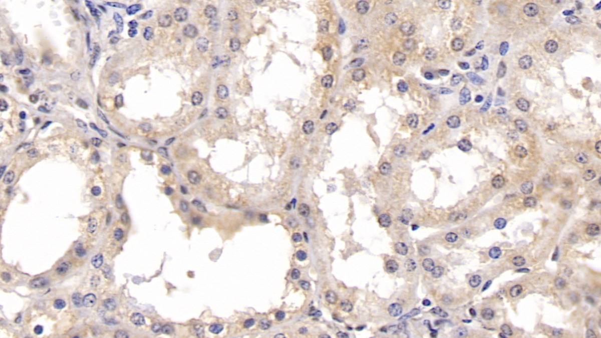 Monoclonal Antibody to Parkinson Disease Protein 7 (PARK7)