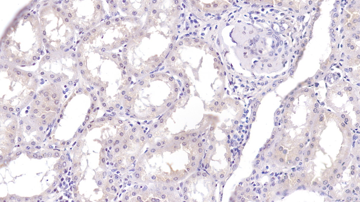 Monoclonal Antibody to Parkinson Disease Protein 7 (PARK7)