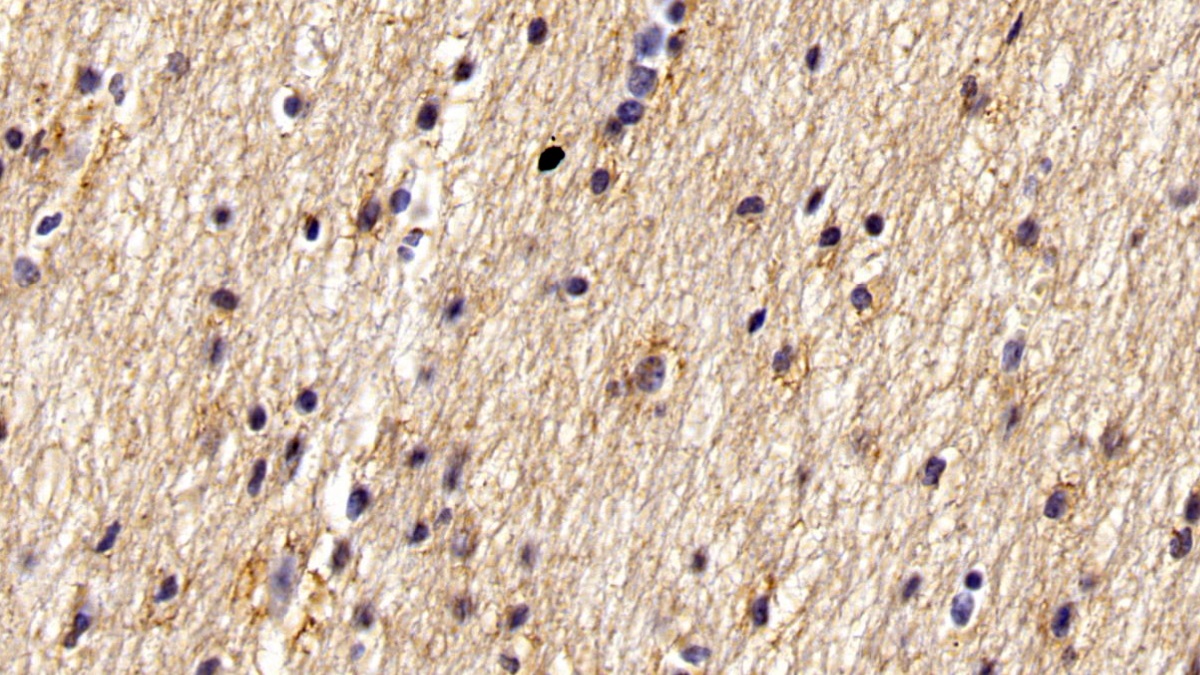 Monoclonal Antibody to Wolfram Syndrome Protein 1 (WFS1)