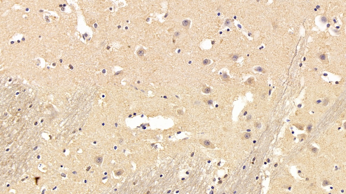 Monoclonal Antibody to Chaperonin Containing TCP1, Subunit 2 (CCT2)