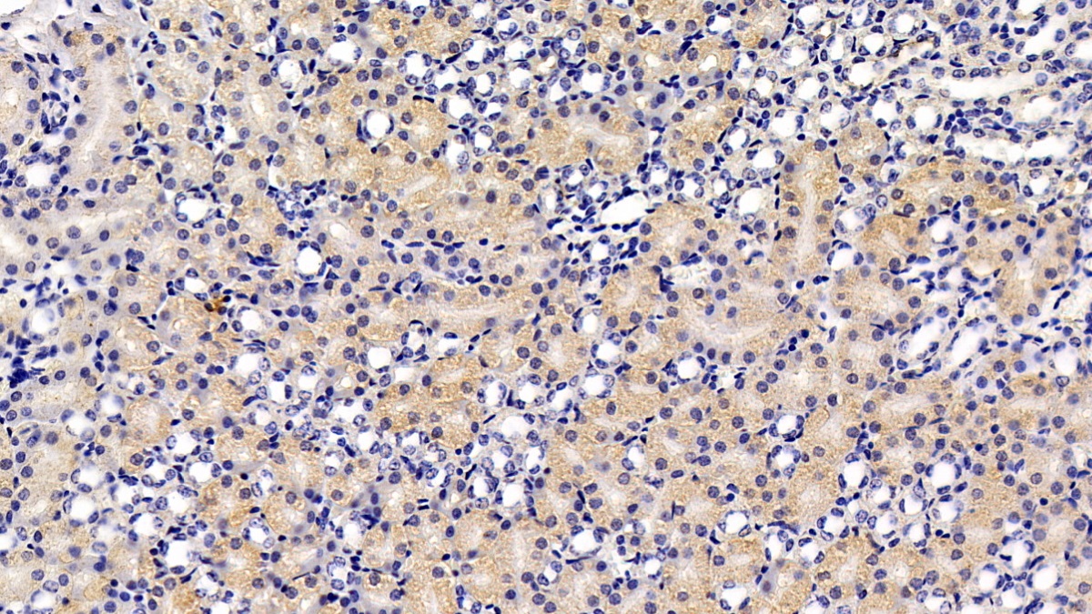 Monoclonal Antibody to Chaperonin Containing TCP1, Subunit 2 (CCT2)