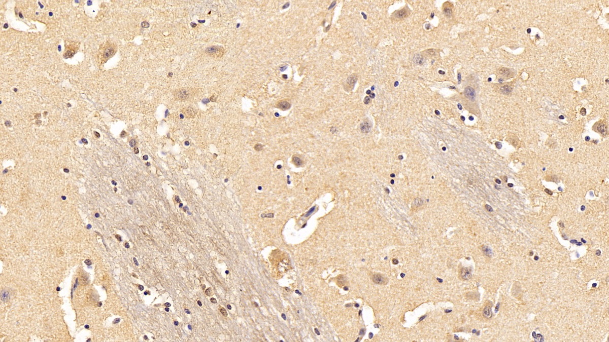 Monoclonal Antibody to Chaperonin Containing TCP1, Subunit 2 (CCT2)