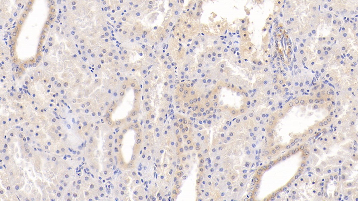 Monoclonal Antibody to Semaphorin 3A (SEMA3A)