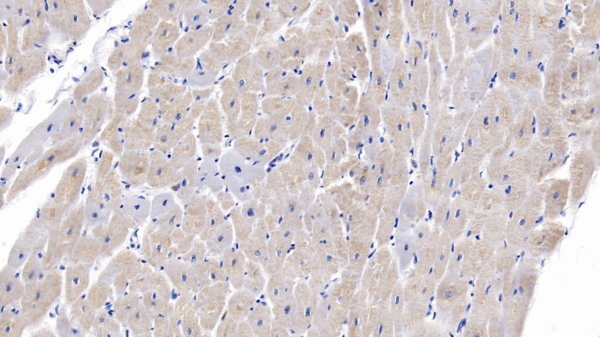 Monoclonal Antibody to Semaphorin 5B (SEMA5B)