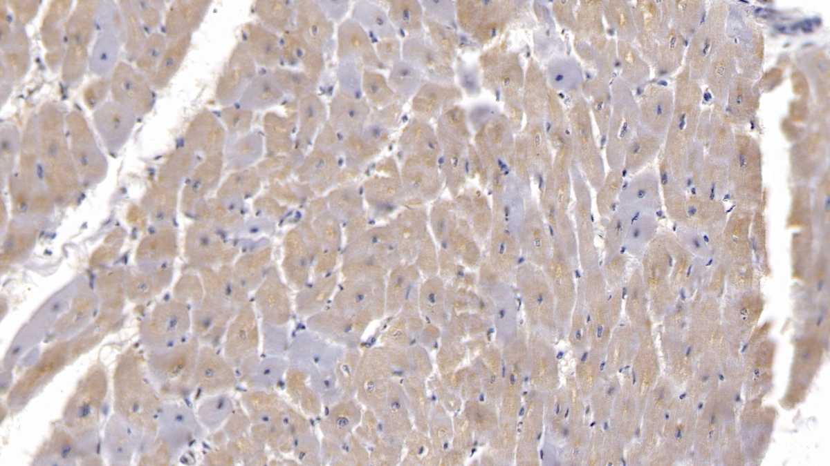 Monoclonal Antibody to Semaphorin 5B (SEMA5B)