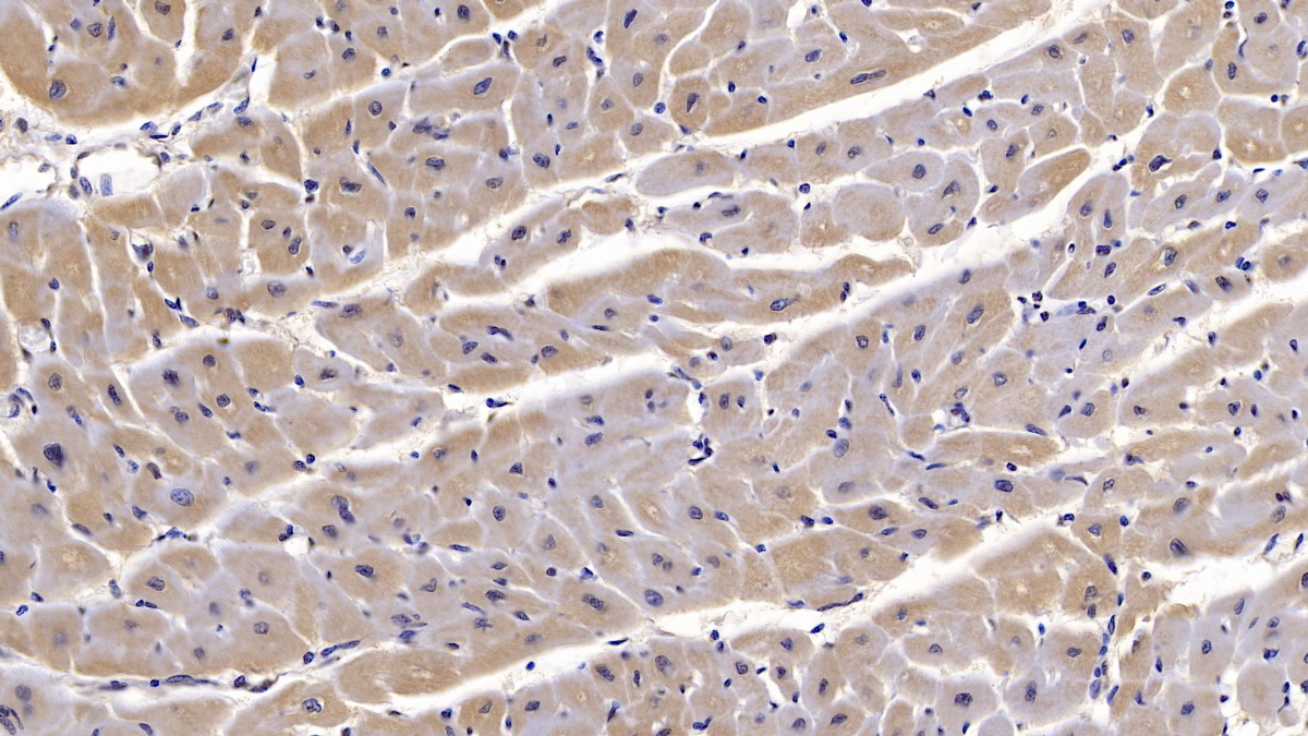 Monoclonal Antibody to Semaphorin 5B (SEMA5B)