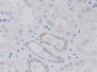 Monoclonal Antibody to V-Ral Simian Leukemia Viral Oncogene Homolog A (RALA)