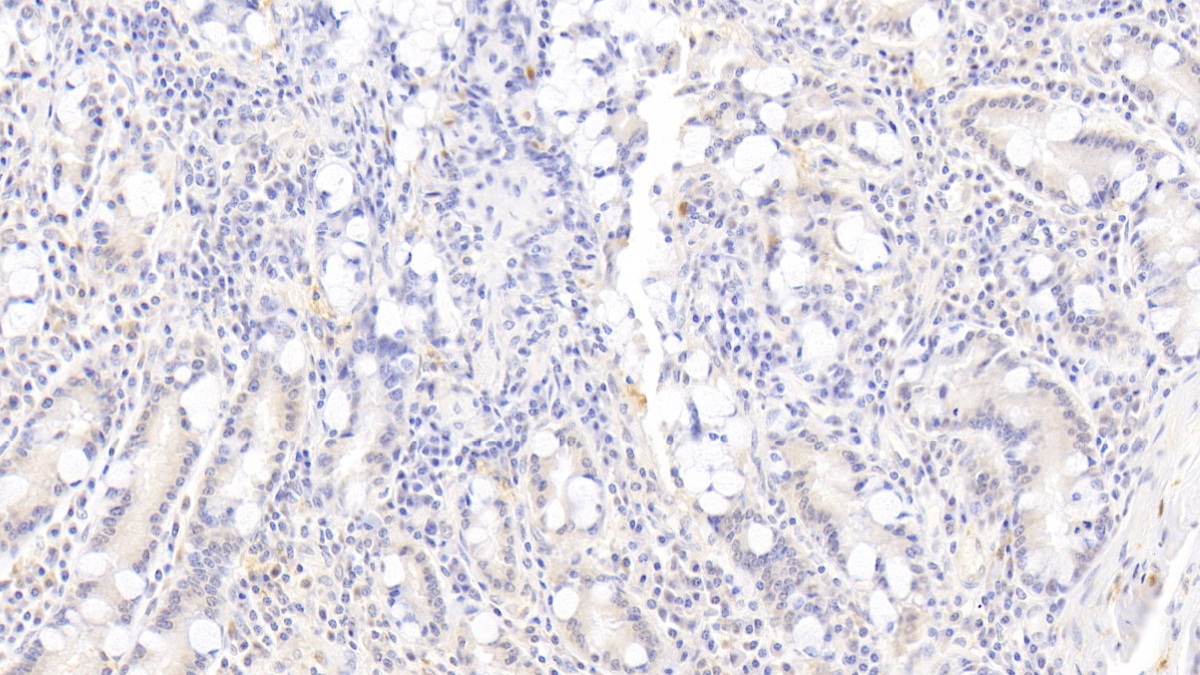 Monoclonal Antibody to Ras Related C3 Botulinum Toxin Substrate 1 (Rac1)