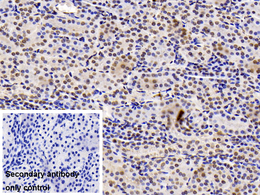 Monoclonal Antibody to Mitochondrial Ribosomal Protein S4 (MRPS4)