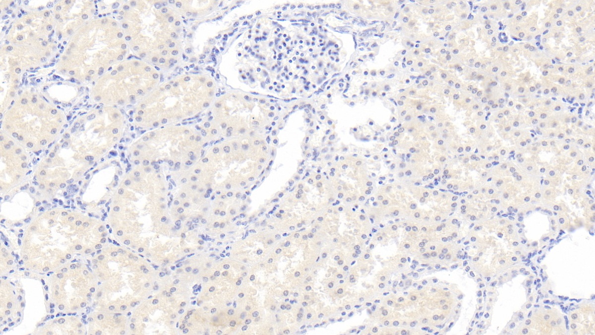 Monoclonal Antibody to Rh Blood Group, D Antigen (RHD)