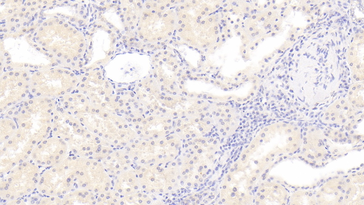 Monoclonal Antibody to Rh Blood Group, D Antigen (RHD)