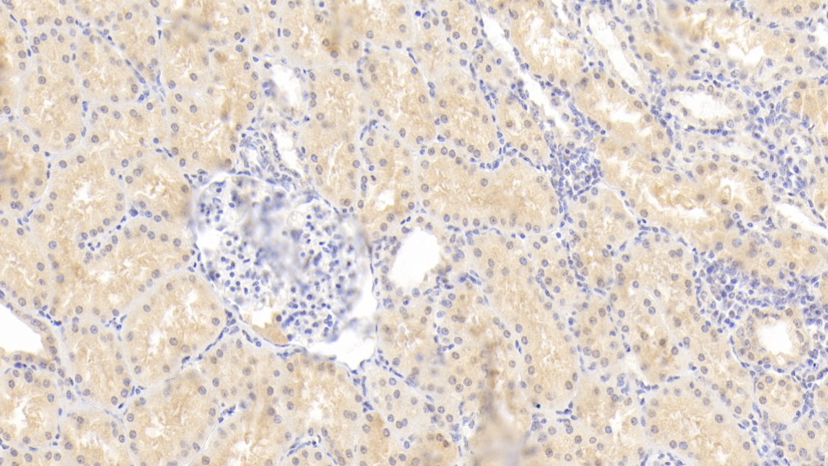 Monoclonal Antibody to Rh Blood Group, D Antigen (RHD)