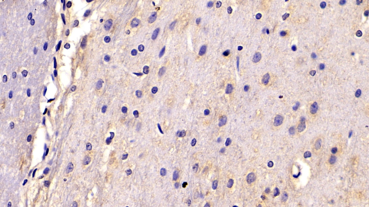 Monoclonal Antibody to Potassium Inwardly Rectifying Channel Subfamily J, Member 10 (KCNJ10)