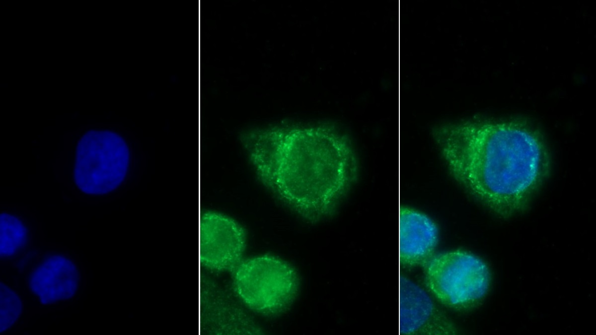 Monoclonal Antibody to Glioblastoma Expressed Ring Finger Protein (GERP)