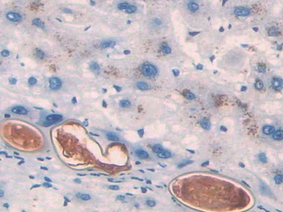 Monoclonal Antibody to Angiotensin 1-7 (Ang1-7)