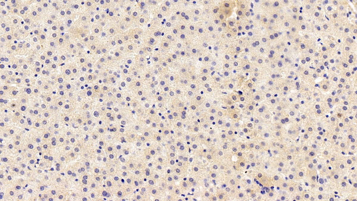 Monoclonal Antibody to Complement Component 4d (C4d)