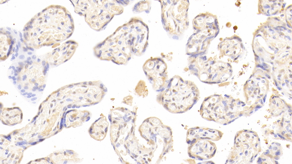 Polyclonal Antibody to Activin A (ACVA)