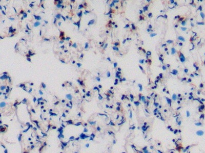 Polyclonal Antibody to Activated Leukocyte Cell Adhesion Molecule (ALCAM)