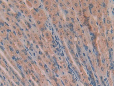 Polyclonal Antibody to Angiogenin (ANG)