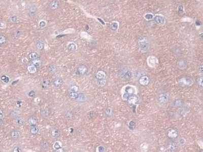 Polyclonal Antibody to Angiopoietin 1 (ANGPT1)