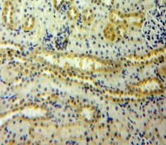 Polyclonal Antibody to Angiopoietin 2 (ANGPT2)