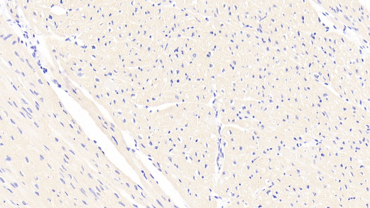 Polyclonal Antibody to Connective Tissue Growth Factor (CTGF)