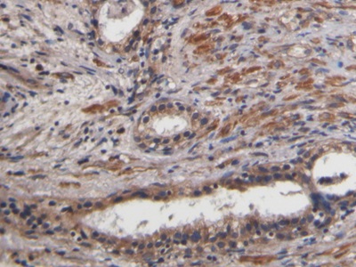 Polyclonal Antibody to Connective Tissue Growth Factor (CTGF)