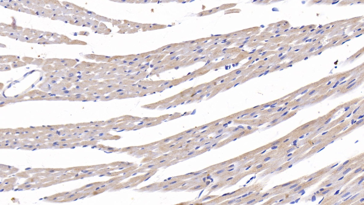 Polyclonal Antibody to Connective Tissue Growth Factor (CTGF)