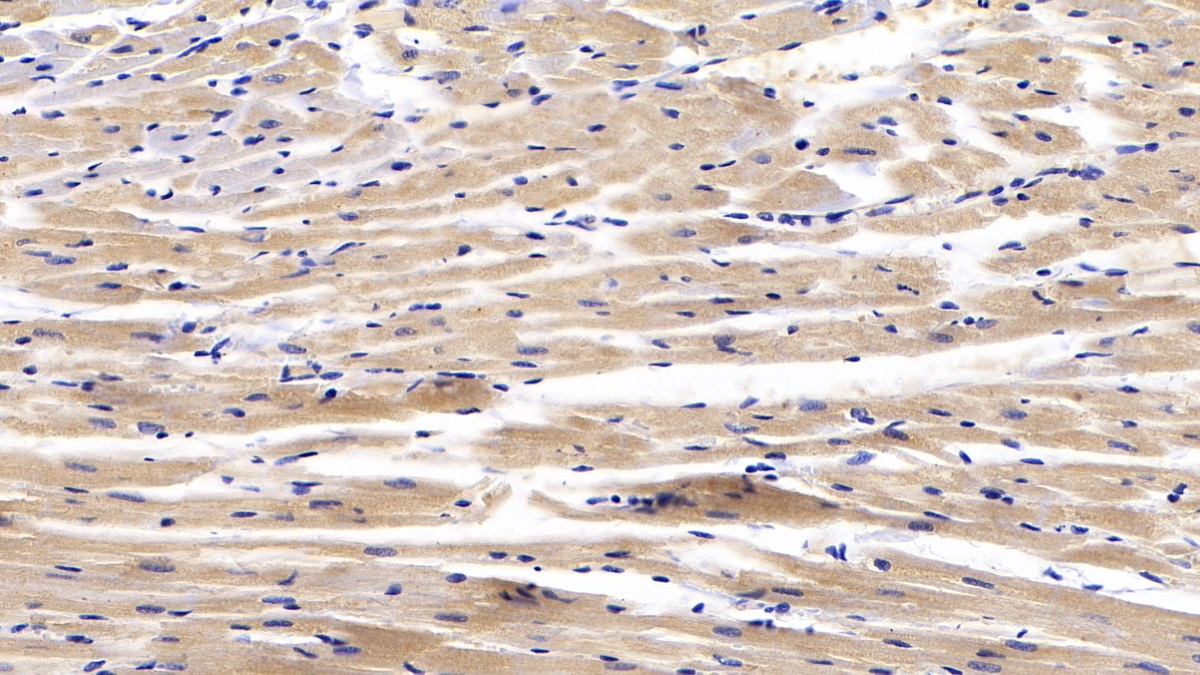 Polyclonal Antibody to Connective Tissue Growth Factor (CTGF)