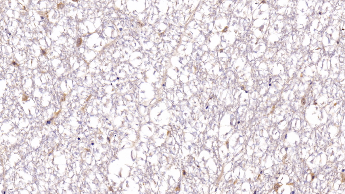 Polyclonal Antibody to Brain Derived Neurotrophic Factor (BDNF)