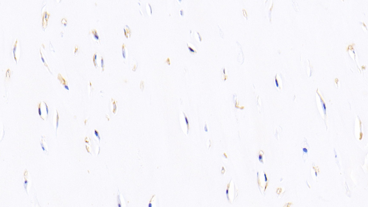 Polyclonal Antibody to Bone Morphogenetic Protein 2 (BMP2)