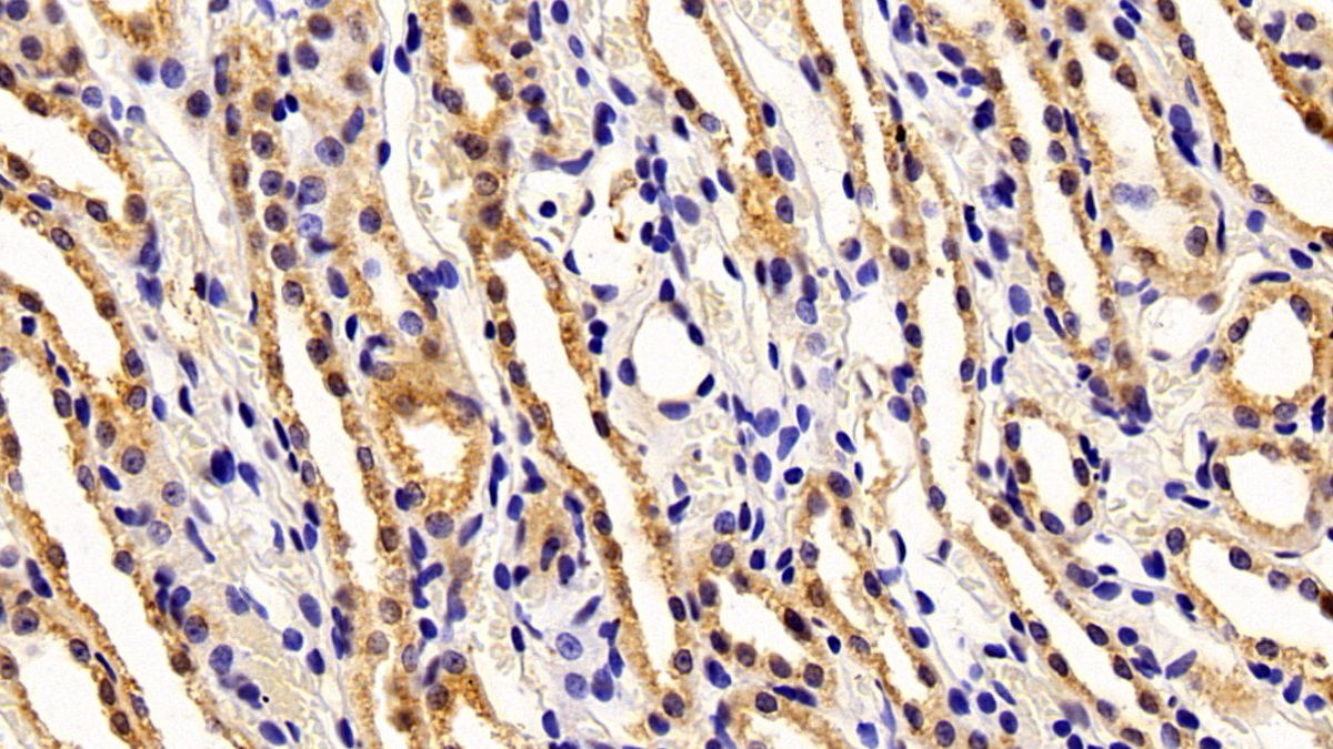 Polyclonal Antibody to Bone Morphogenetic Protein 4 (BMP4)