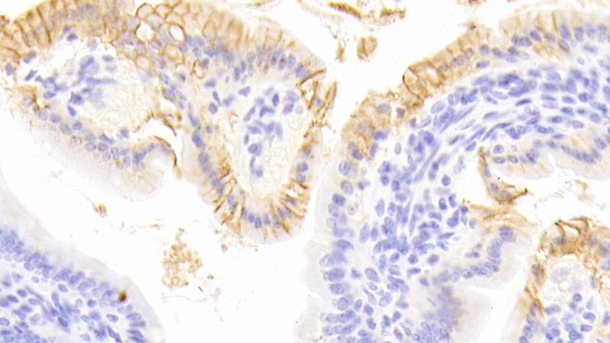 Polyclonal Antibody to E-cadherin