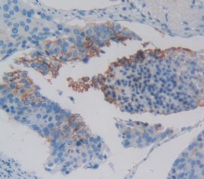 Polyclonal Antibody to Chemokine C-Motif Receptor 1 (XCR1)