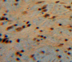 Polyclonal Antibody to Ciliary Neurotrophic Factor (CNTF)