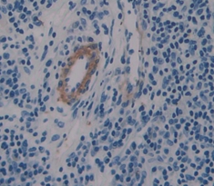 Polyclonal Antibody to Endocrine Gland Derived Vascular Endothelial Growth Factor (EG-VEGF)