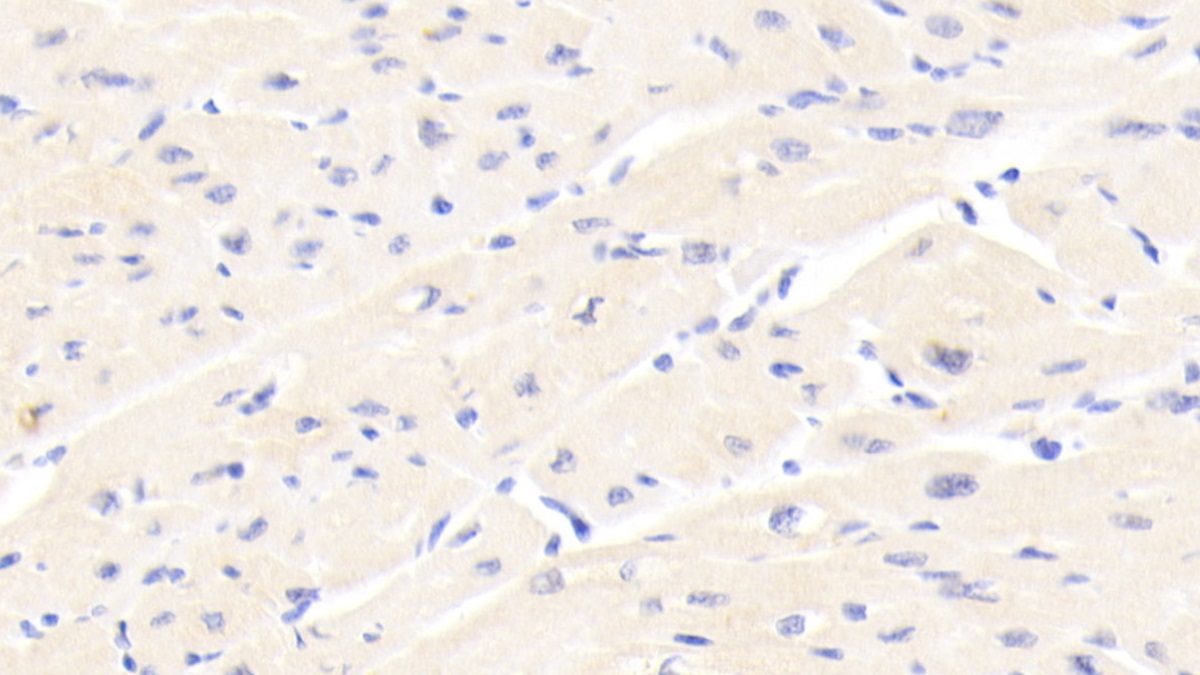 Polyclonal Antibody to Erythropoietin Receptor (EPOR)