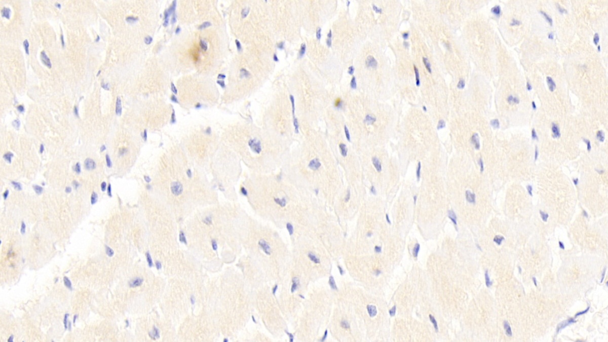 Polyclonal Antibody to Erythropoietin Receptor (EPOR)