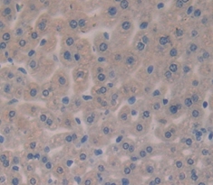 Polyclonal Antibody to Erythropoietin (EPO)