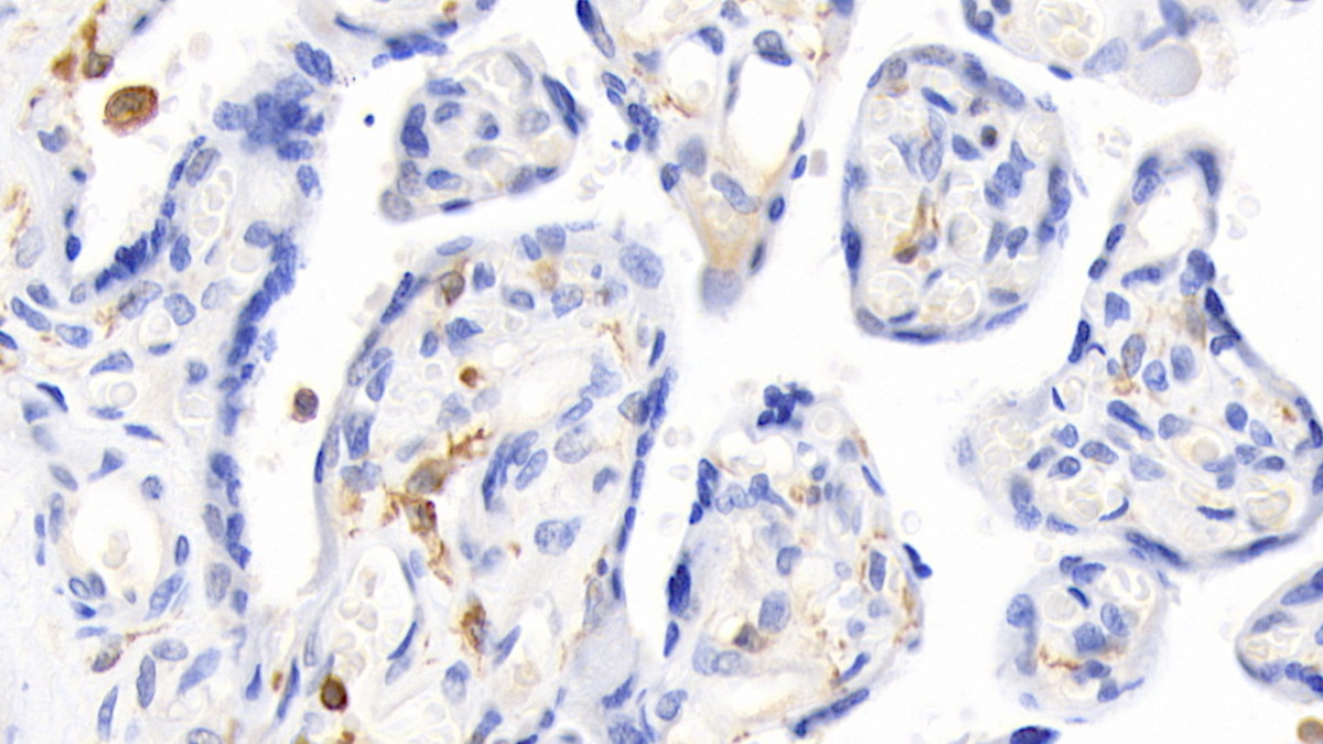 Polyclonal Antibody to Erythropoietin (EPO)