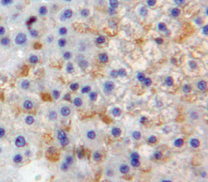 Polyclonal Antibody to E-selectin