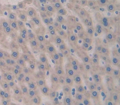 Polyclonal Antibody to Factor Related Apoptosis (FAS)