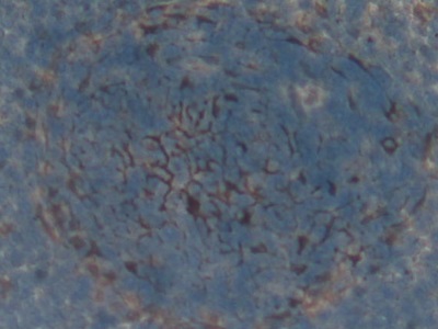 Polyclonal Antibody to Factor Related Apoptosis (FAS)