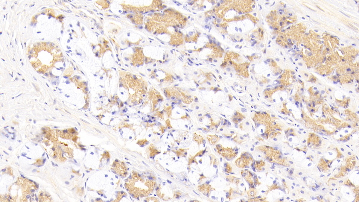 Polyclonal Antibody to Factor Related Apoptosis Ligand (FASL)