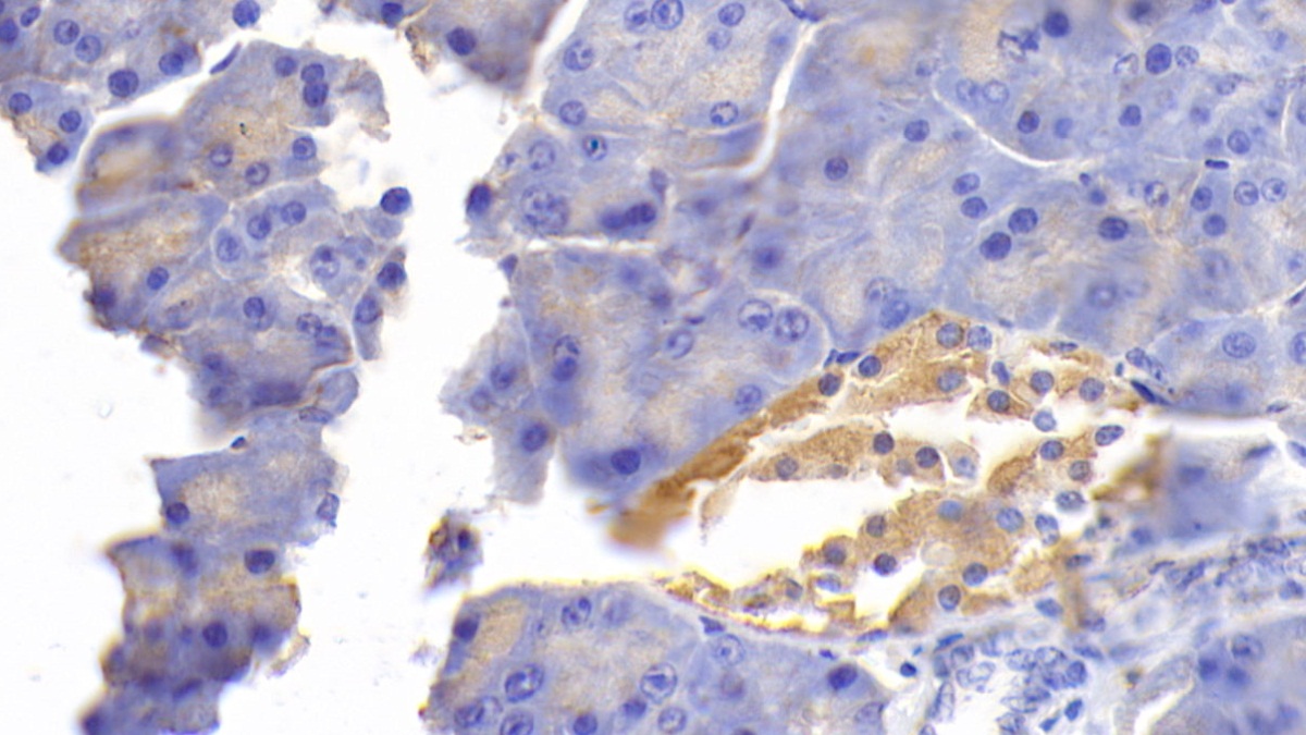 Polyclonal Antibody to Fibronectin (FN)